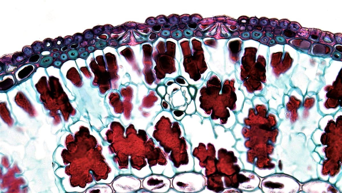 SIBO and Leaky Gut: Zonulin, Endotoxemia & Intestinal Permeability