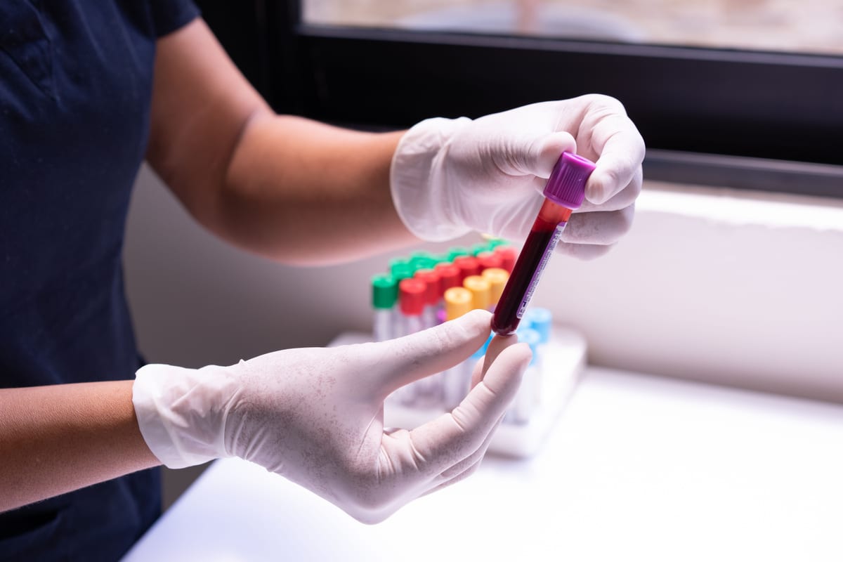 Blood tests for small intestinal bacterial overgrowth
