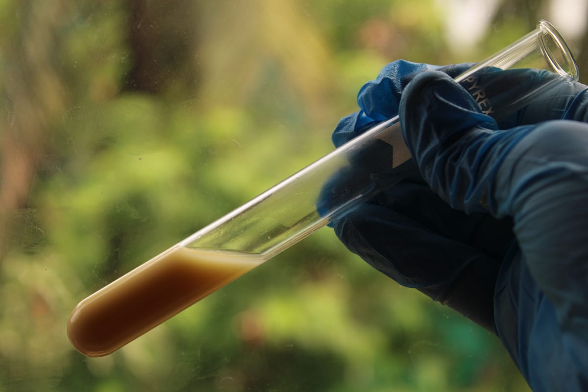 Stool Tests for SIBO: Technologies, Markers, and Mechanisms